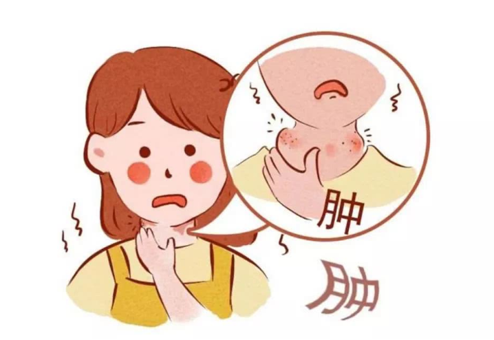 扁桃體發(fā)炎吃什么藥好得快？扁桃體發(fā)炎飲食禁忌有哪些？